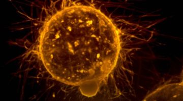 Ca lâm sàng test 1